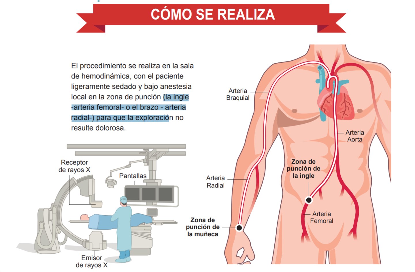 cateterismo cardiaco OkyjoL