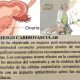 Riesgo cardiovascular producto del fallo ovarico prematuro efe 7Sk2hp