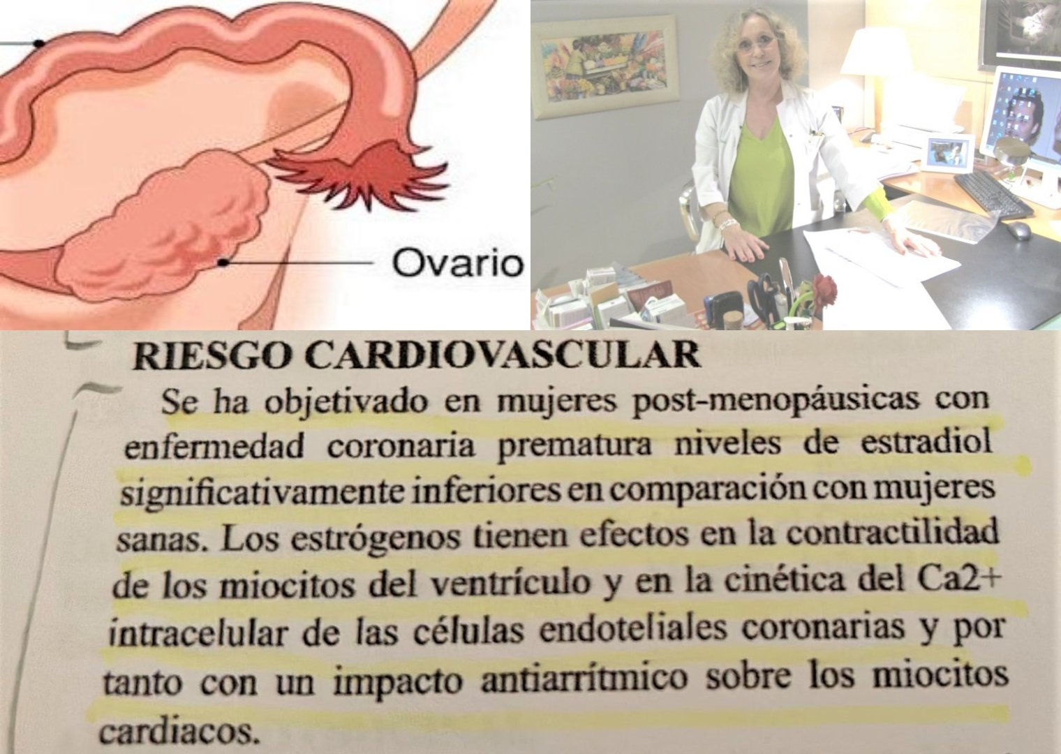 Riesgo cardiovascular producto del fallo ovarico prematuro efe 7Sk2hp